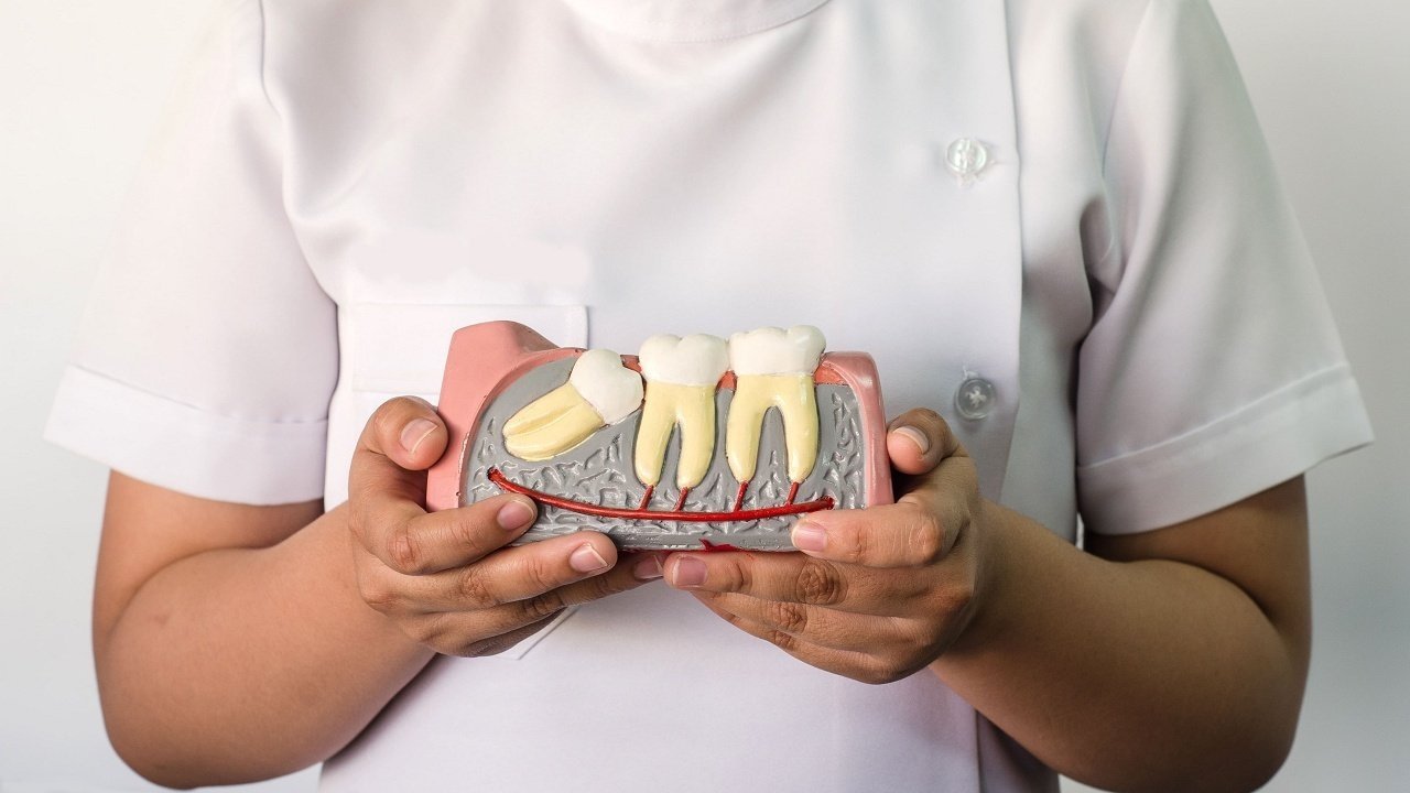 Pencabutan Gigi dan Odontektomi | Seraphic Smile